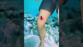 How Stingrays Actually Sting You 😳