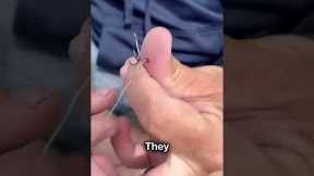 Fishing Hook Got Stuck😨